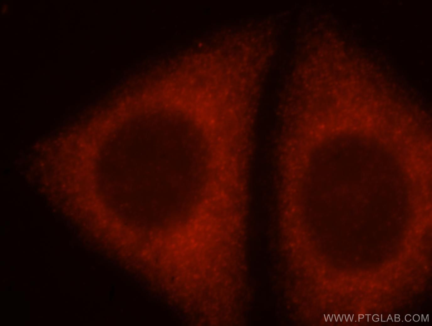 ADAM12 Immunofluorescence IF 14139-1-AP ADAM12 Antibody MCMP; MCMPMltna; MLTN; MLTNA