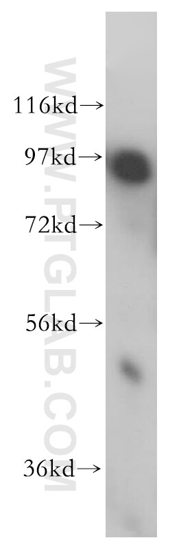 ADAM12 western blot WB 14139-1-AP ADAM12 Antibody MCMP; MCMPMltna; MLTN; MLTNA
