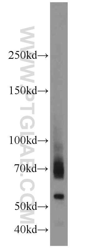 mouse testis tissue were subjected to SDS PAGE followed by western blot with 13952-1-AP(ADAM2 Antibody) at dilution of 1:500 ADAM2 western blot WB 13952-1-AP ADAM2 Antibody CRYN1; CRYN2; CT15; FTNB; PH-30b; PH30