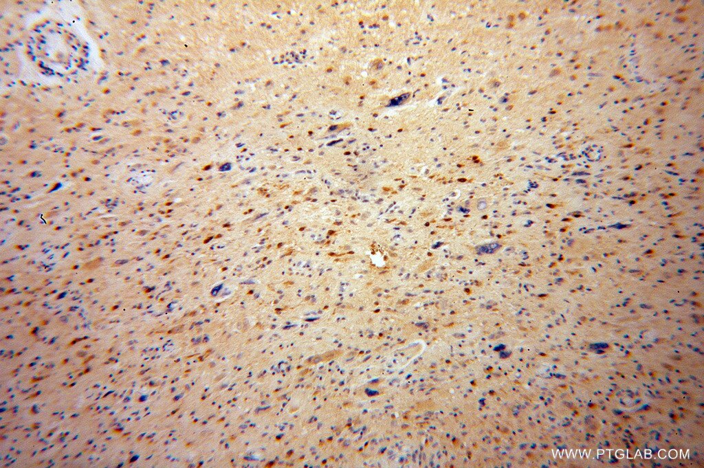 ADAP1 IHC Immunohistochemical 13911-1-AP ADAP1 Antibody CENTA1; GCS1L; p42IP4