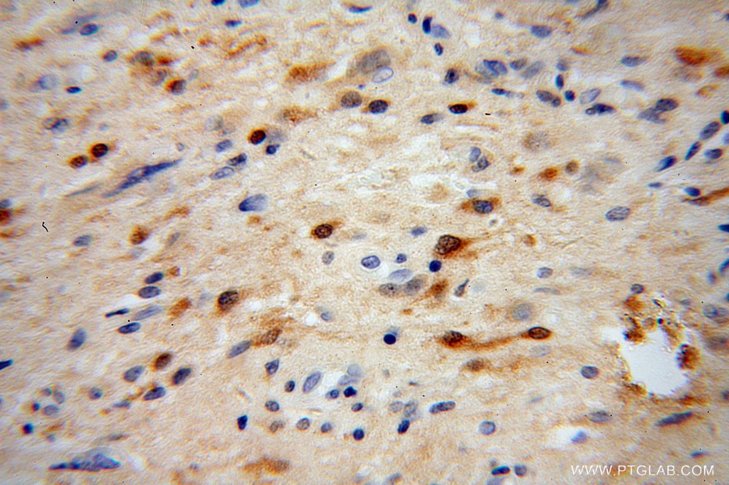 ADAP1 IHC Immunohistochemical 13911-1-AP ADAP1 Antibody CENTA1; GCS1L; p42IP4