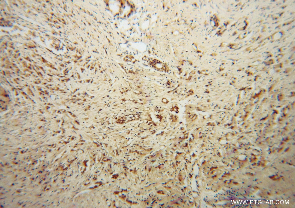 ADAR1 IHC Immunohistochemical 14330-1-AP ADAR1 Antibody ADAR1; DRADA; DSH; DSRAD; G1P1; IFI-4; IFI4; K88dsRBP; p136