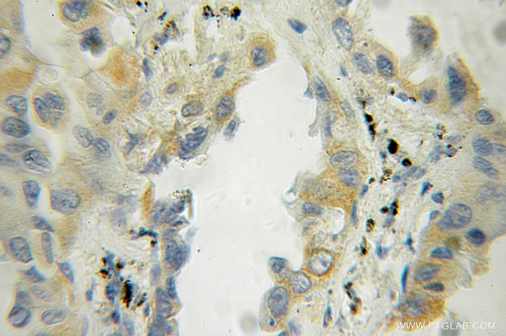 ADRB2 IHC Immunohistochemical 13096-1-AP ADRB2 Antibody ADRB2R; ADRBR; B2AR; BAR; BETA2AR