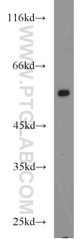 ADRB2 western blot WB 13096-1-AP ADRB2 Antibody ADRB2R; ADRBR; B2AR; BAR; BETA2AR