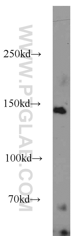 K-562 cells were subjected to SDS PAGE followed by western blot with 19975-1-AP(AFF1-Specific Antibody) at dilution of 1:300 AFF1-Specific western blot WB 19975-1-AP AFF1-Specific Antibody AF-4; AF4; AF4-MLL; MGC134969; MLL/AF4; MLLT2; PBM1