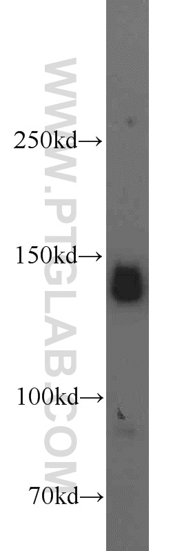 L02 cells were subjected to SDS PAGE followed by western blot with 14662-1-AP(AFF4 Antibody) at dilution of 1:500 AFF4 western blot WB 14662-1-AP AFF4 Antibody AF5Q31; MCEF; MGC75036