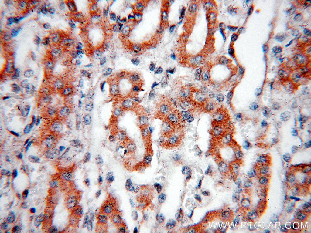 AFG3L2 IHC Immunohistochemical 14631-1-AP AFG3L2 Antibody FLJ25993