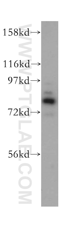 AFG3L2 western blot WB 14631-1-AP AFG3L2 Antibody FLJ25993