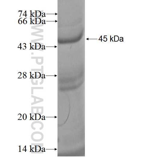 AGR3 fusion protein ag2577 SDS-PAGE
