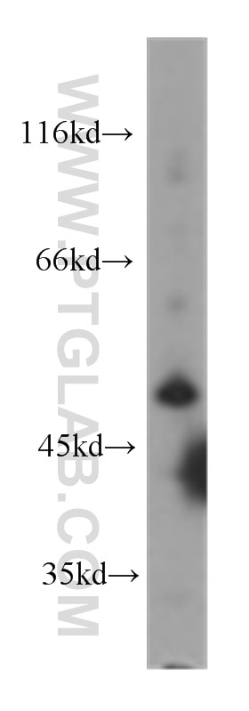 Hepg2 cells were subjected to SDS PAGE followed by western blot with 60126-1-Ig(AGT Antibody) at dilution of 1:1000 AGT western blot WB 60126-1-Ig AGT Antibody ANHU; FLJ92595; FLJ97926; SERPINA8