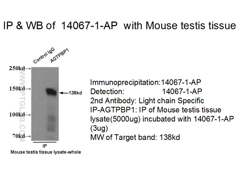 CCP1 IP 14067-1-AP CCP1 Antibody DKFZp686M20191; KIAA1035; NNA1