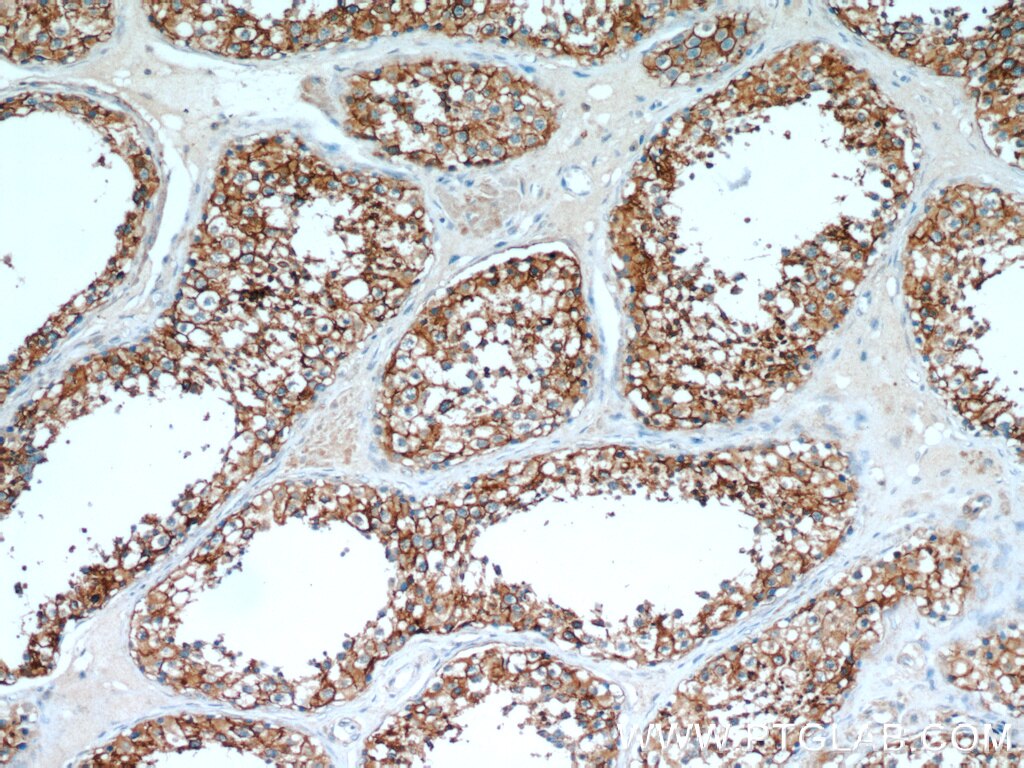 CCP1 IHC Immunohistochemical 14067-1-AP CCP1 Antibody DKFZp686M20191; KIAA1035; NNA1