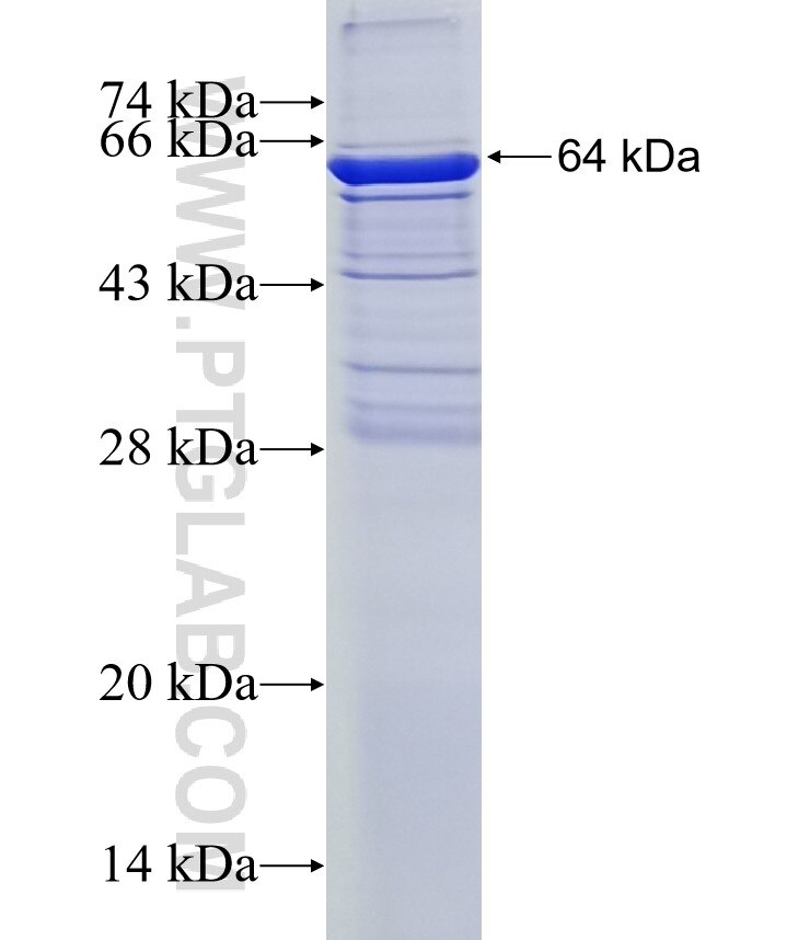 CCP1 fusion protein ag5122 SDS-PAGE