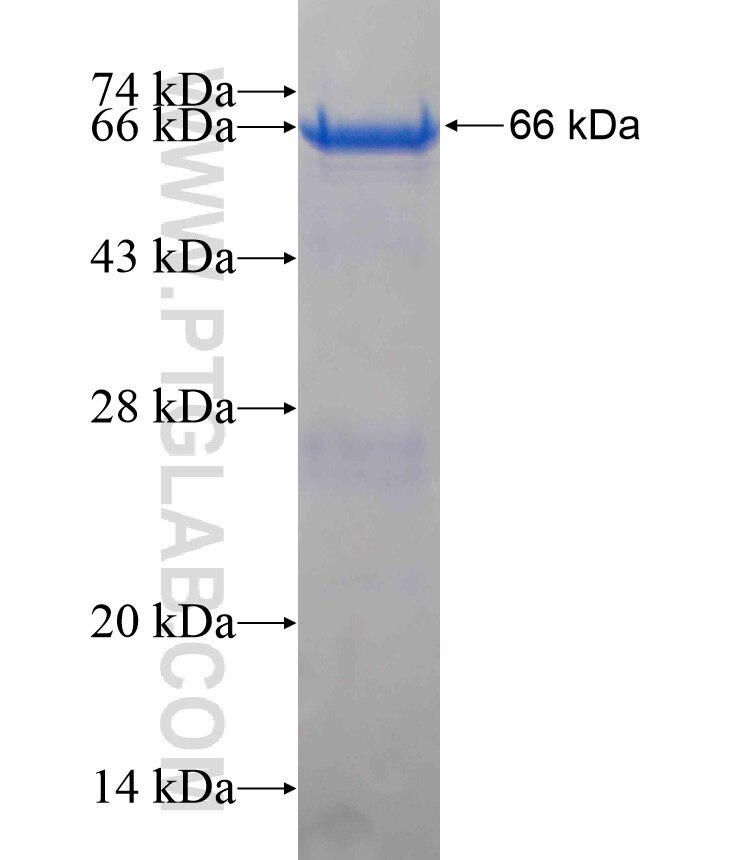 AGXT fusion protein ag18062 SDS-PAGE