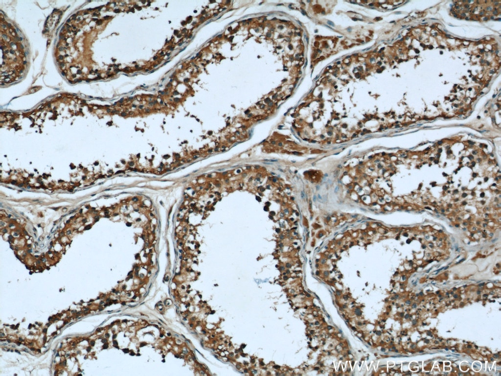 AHCY IHC Immunohistochemical 66019-1-Ig AHCY Antibody SAHH