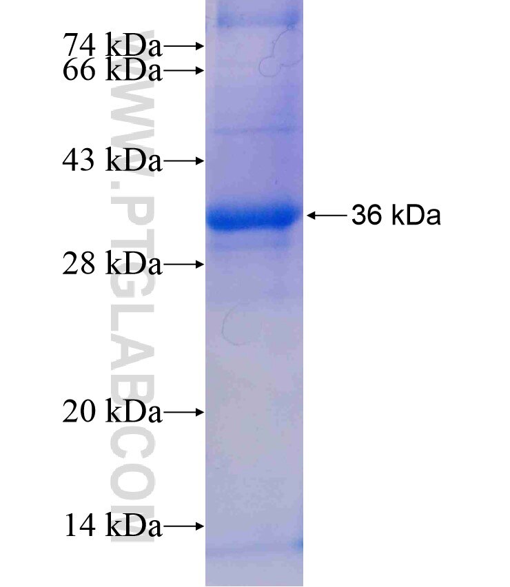 AHCY fusion protein ag18036 SDS-PAGE