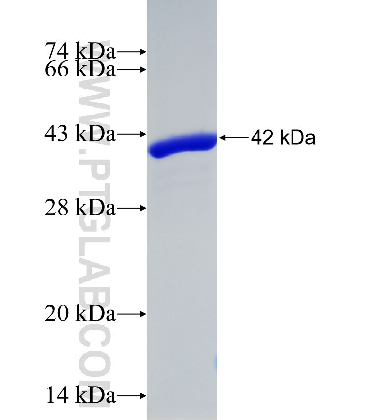 AHNAK fusion protein ag3238 SDS-PAGE