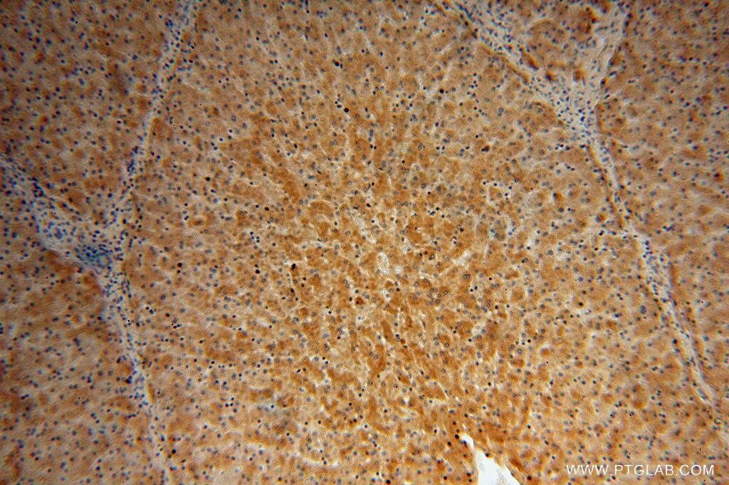 AHSG IHC Immunohistochemical 16571-1-AP AHSG Antibody A2HS; AHS; FETUA; HSGA