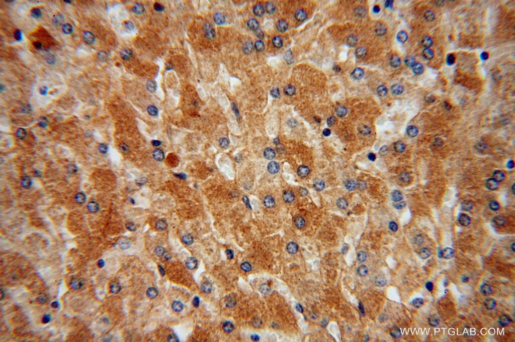 AHSG IHC Immunohistochemical 16571-1-AP AHSG Antibody A2HS; AHS; FETUA; HSGA