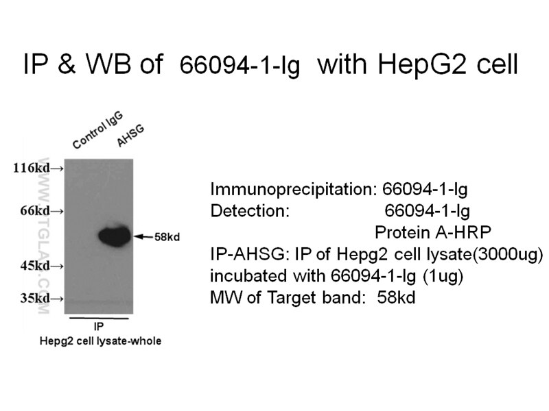 AHSG IP 66094-1-Ig AHSG Antibody A2HS; AHS; FETUA; HSGA