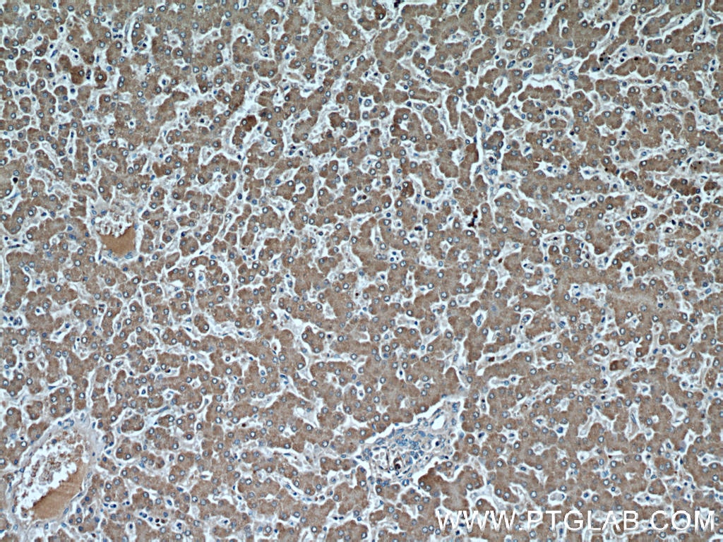 AHSG IHC Immunohistochemical 66094-1-Ig AHSG Antibody A2HS; AHS; FETUA; HSGA