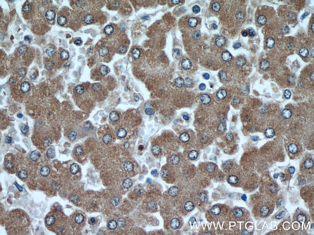 AHSG IHC Immunohistochemical 66094-1-Ig AHSG Antibody A2HS; AHS; FETUA; HSGA