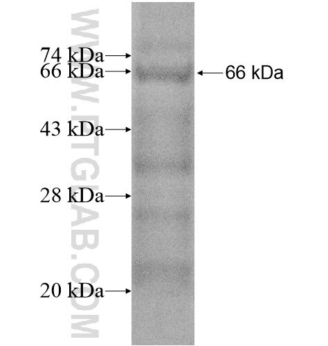 AIM2 fusion protein ag14520 SDS-PAGE