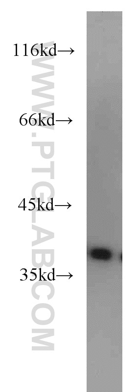 HepG2 cells were subjected to SDS PAGE followed by western blot with 18176-1-AP(AIP Antibody) at dilution of 1:1000 AIP western blot WB 18176-1-AP AIP Antibody ARA9; FKBP16; FKBP37; SMTPHN; XAP2