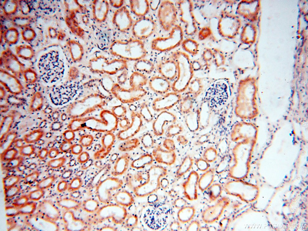 AKAP3 IHC Immunohistochemical 13907-1-AP AKAP3 Antibody AKAP110; CT82; FSP95; PRKA3; SOB1