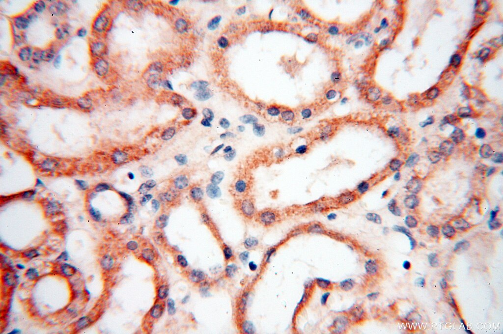 AKAP3 IHC Immunohistochemical 13907-1-AP AKAP3 Antibody AKAP110; CT82; FSP95; PRKA3; SOB1