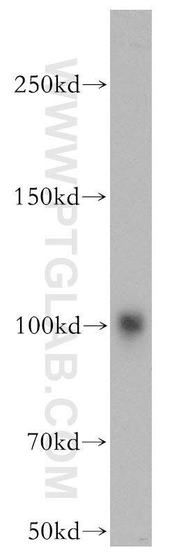 AKAP3 western blot WB 13907-1-AP AKAP3 Antibody AKAP110; CT82; FSP95; PRKA3; SOB1