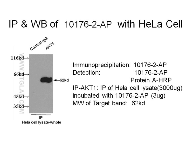 AKT IP 10176-2-AP AKT Antibody AKT; MGC99656; PKB; PKB-ALPHA; PRKBA; RAC; RAC-ALPHA