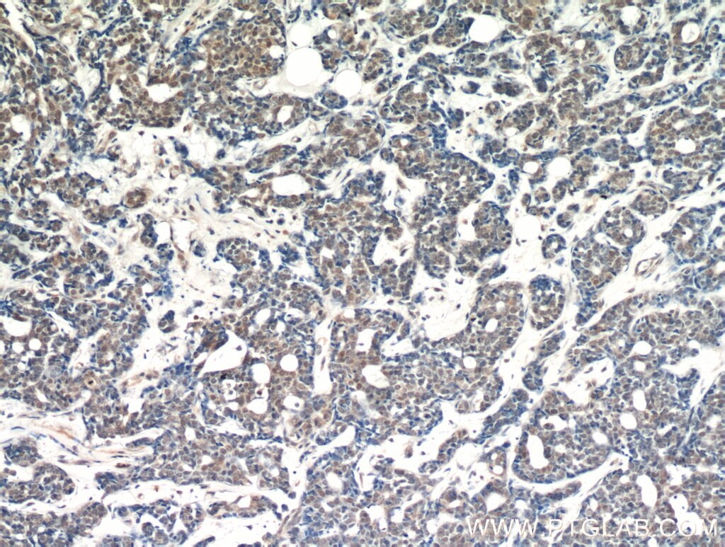 AKT IHC Immunohistochemical 10176-2-AP AKT Antibody AKT; MGC99656; PKB; PKB-ALPHA; PRKBA; RAC; RAC-ALPHA