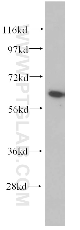 AKT western blot WB 10176-2-AP AKT Antibody AKT; MGC99656; PKB; PKB-ALPHA; PRKBA; RAC; RAC-ALPHA