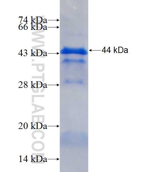 ALAS2 fusion protein ag13524 SDS-PAGE
