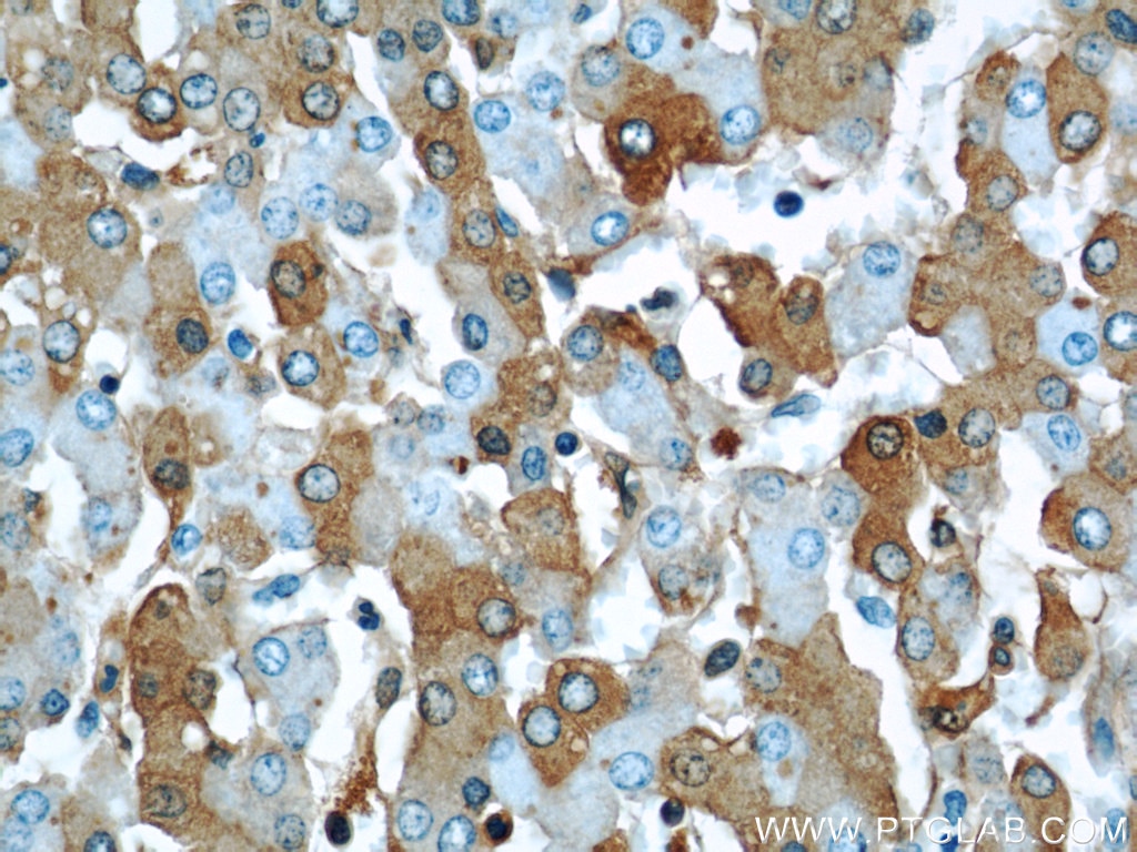 ALB IHC Immunohistochemical 66051-1-Ig ALB Antibody DKFZp779N1935; PRO0883; PRO0903; PRO1341