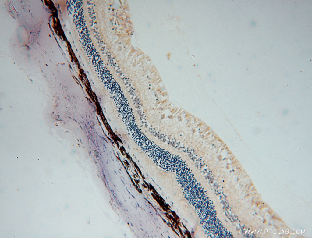 ALDH1A1 IHC Immunohistochemical 15910-1-AP ALDH1A1 Antibody ALDC; ALDH-E1; ALDH1; ALDH11; MGC2318; PUMB1; RALDH1