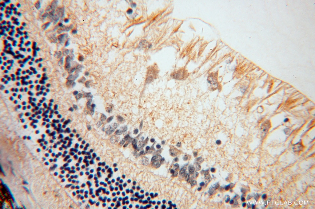 ALDH1A1 IHC Immunohistochemical 15910-1-AP ALDH1A1 Antibody ALDC; ALDH-E1; ALDH1; ALDH11; MGC2318; PUMB1; RALDH1