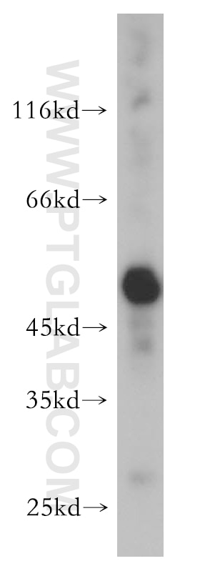 ALDH1A1 western blot WB 15910-1-AP ALDH1A1 Antibody ALDC; ALDH-E1; ALDH1; ALDH11; MGC2318; PUMB1; RALDH1
