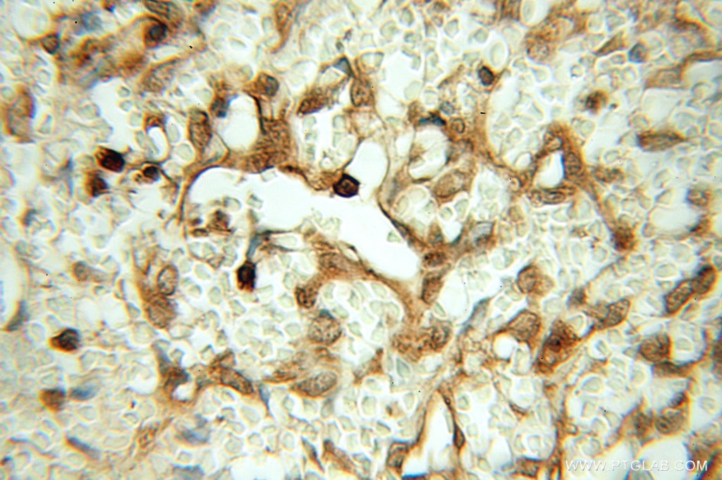 ALDH7A1 IHC Immunohistochemical 10368-1-AP ALDH7A1 Antibody ATQ1; EPD; FLJ11738; FLJ92814; PDE