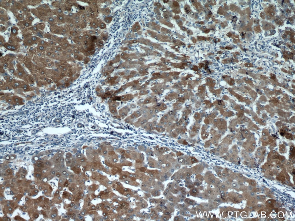 ALDH8A1 IHC Immunohistochemical 21602-1-AP ALDH8A1 Antibody ALDH12; DJ352A20.2; DKFZp779D2315; MGC138650