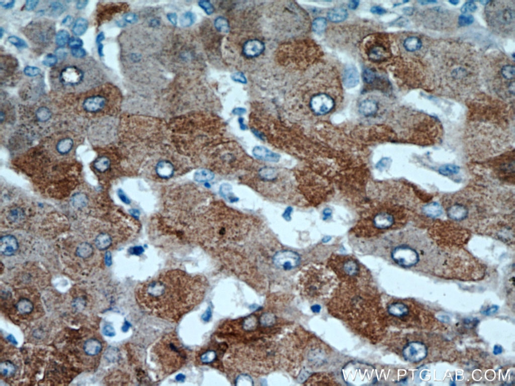 ALDH8A1 IHC Immunohistochemical 21602-1-AP ALDH8A1 Antibody ALDH12; DJ352A20.2; DKFZp779D2315; MGC138650