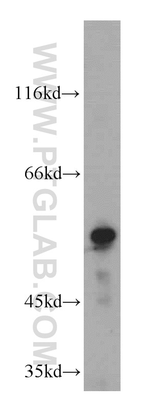 ALDH8A1 western blot WB 21602-1-AP ALDH8A1 Antibody ALDH12; DJ352A20.2; DKFZp779D2315; MGC138650