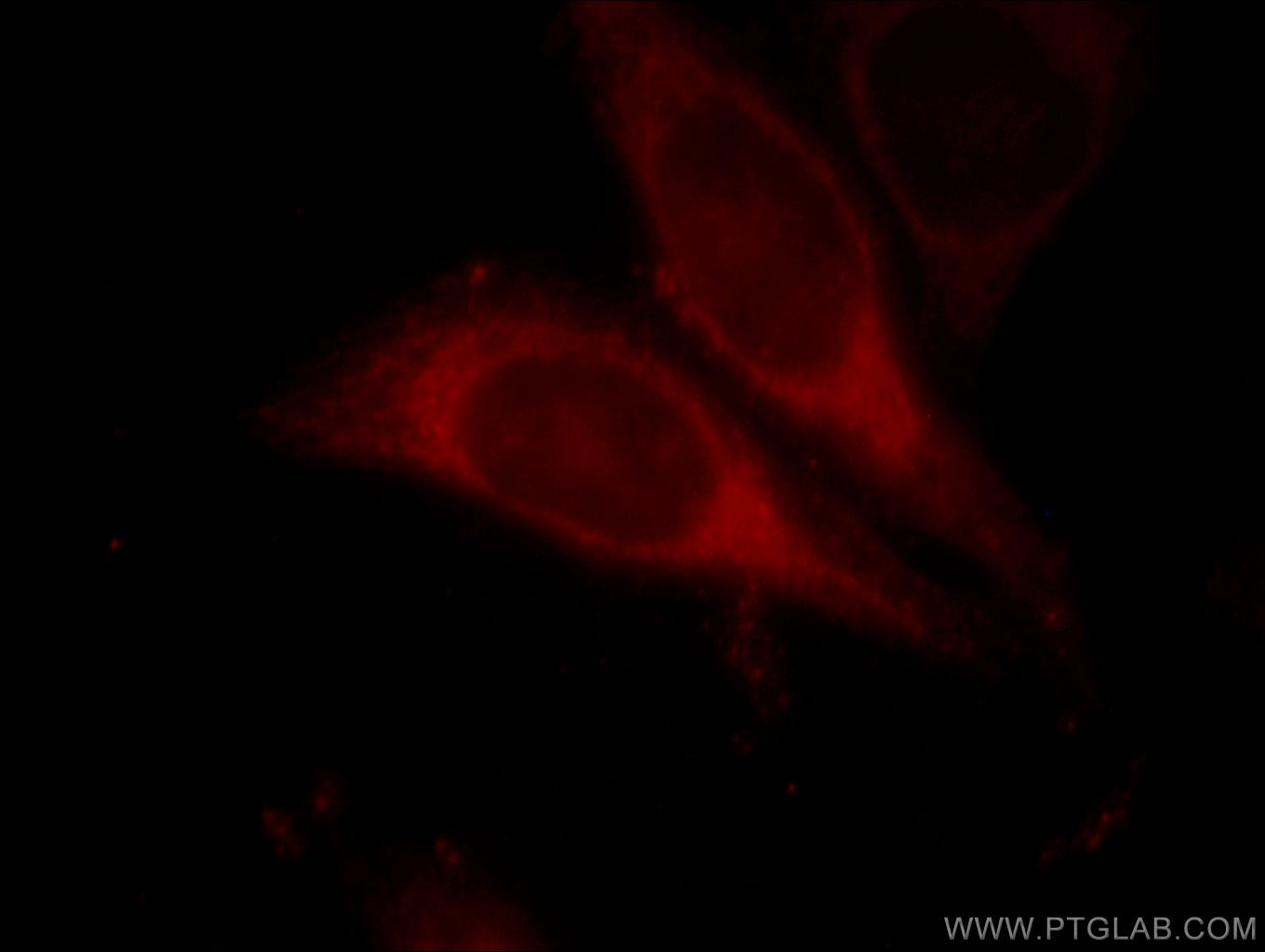 ALDOB Immunofluorescence IF 18065-1-AP ALDOB Antibody 