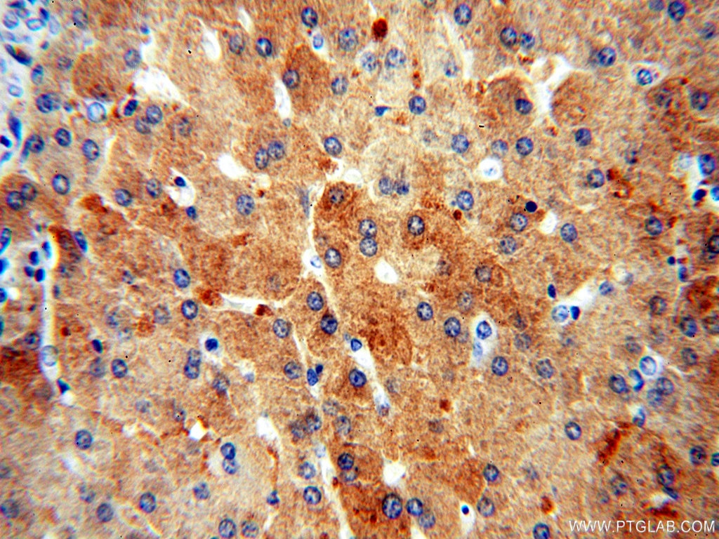 ALDOB IHC Immunohistochemical 18065-1-AP ALDOB Antibody 