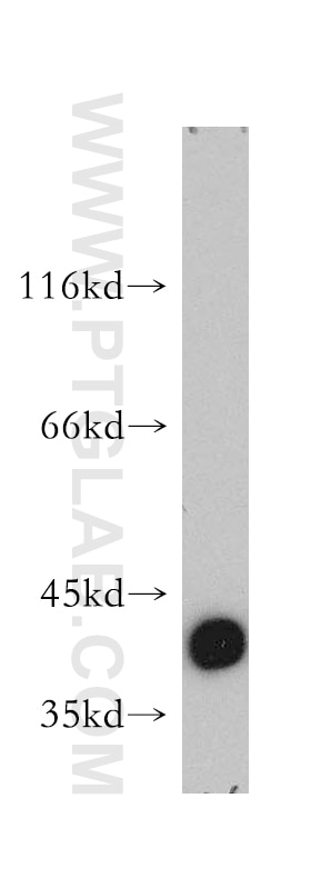mouse cerebellum tissue were subjected to SDS PAGE followed by western blot with 14884-1-AP(ALDOC Antibody) at dilution of 1:1200 ALDOC western blot WB 14884-1-AP ALDOC Antibody ALDC
