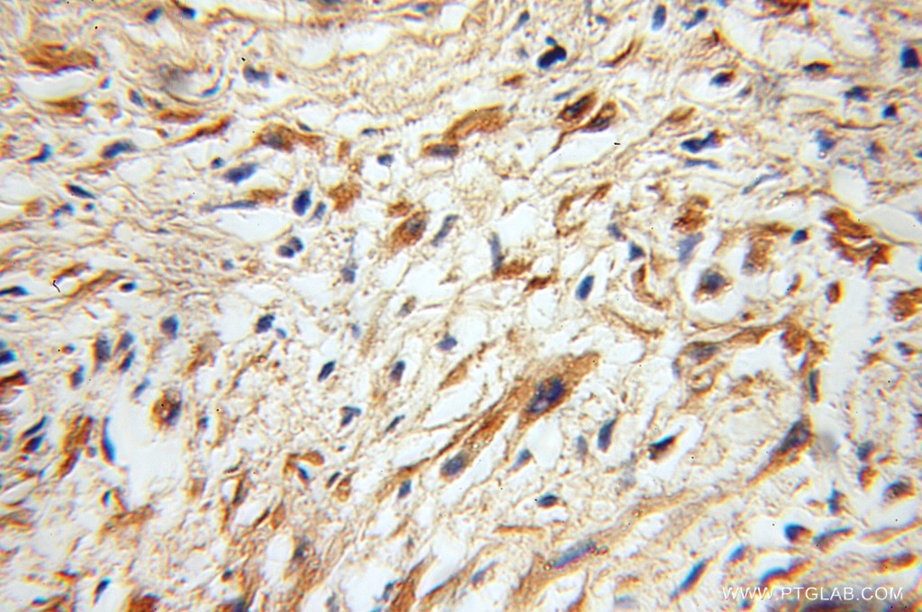 ALG1 IHC Immunohistochemical 12872-1-AP ALG1 Antibody HMAT1; HMT-1; HMT1