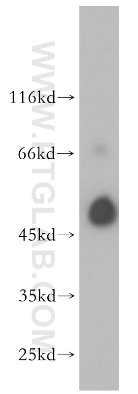 ALG1 western blot WB 12872-1-AP ALG1 Antibody HMAT1; HMT-1; HMT1