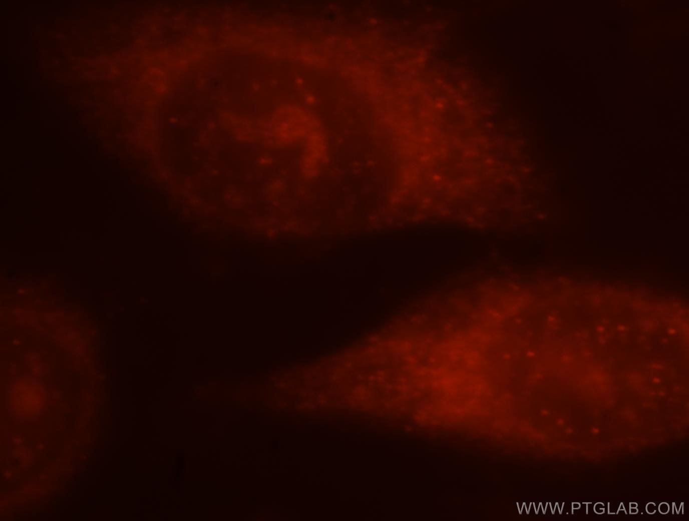 ALOX5 Immunofluorescence IF 10021-1-Ig ALOX5 Antibody 5-LO; 5-LOX; 5LPG; LOG5; MGC163204