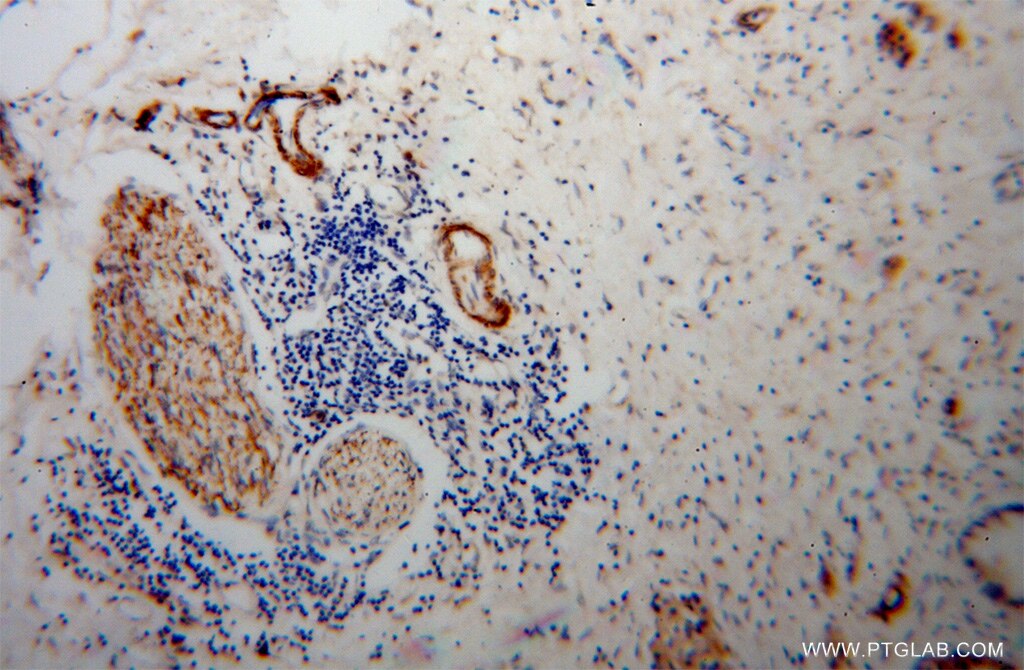 AMPH IHC Immunohistochemical 13379-1-AP AMPH Antibody AMPH1